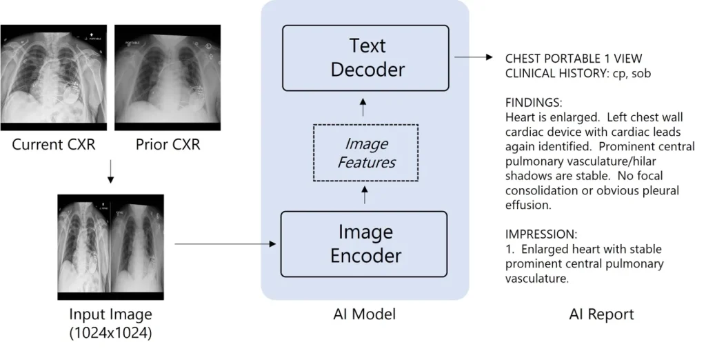 Generative mLLM for chest x-ray interpretation